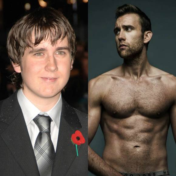 19 Celebs Who Went From Not To Hot